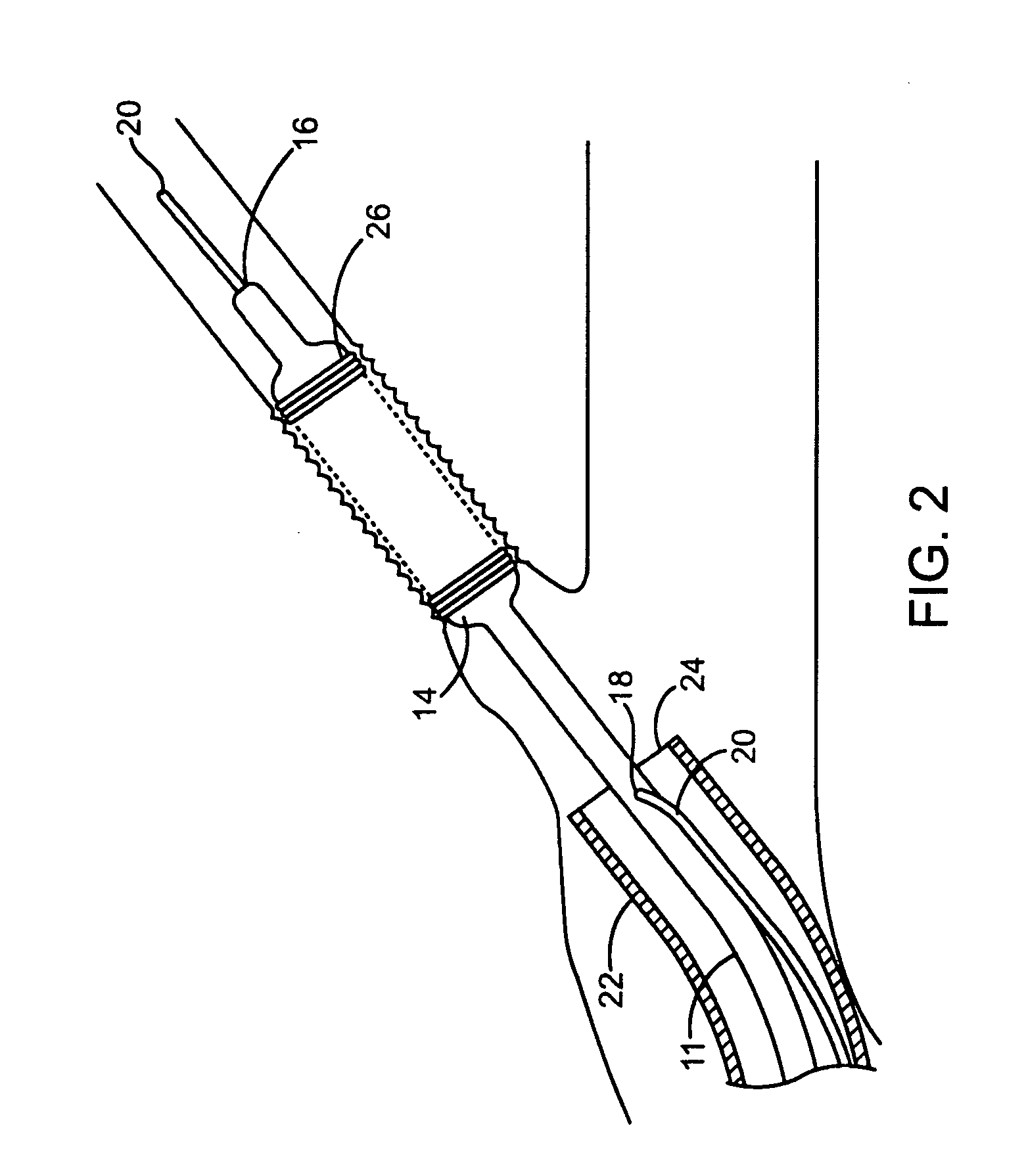 Rapid exchange stent delivery catheter