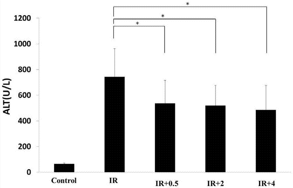 Application of methane injection in preparation of medicaments for treating ischemia-reperfusion injury