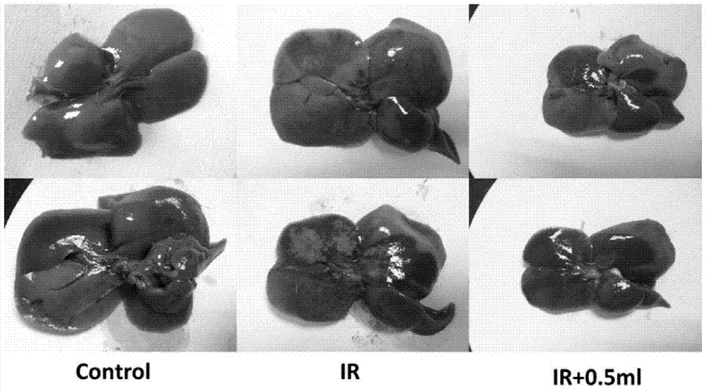 Application of methane injection in preparation of medicaments for treating ischemia-reperfusion injury