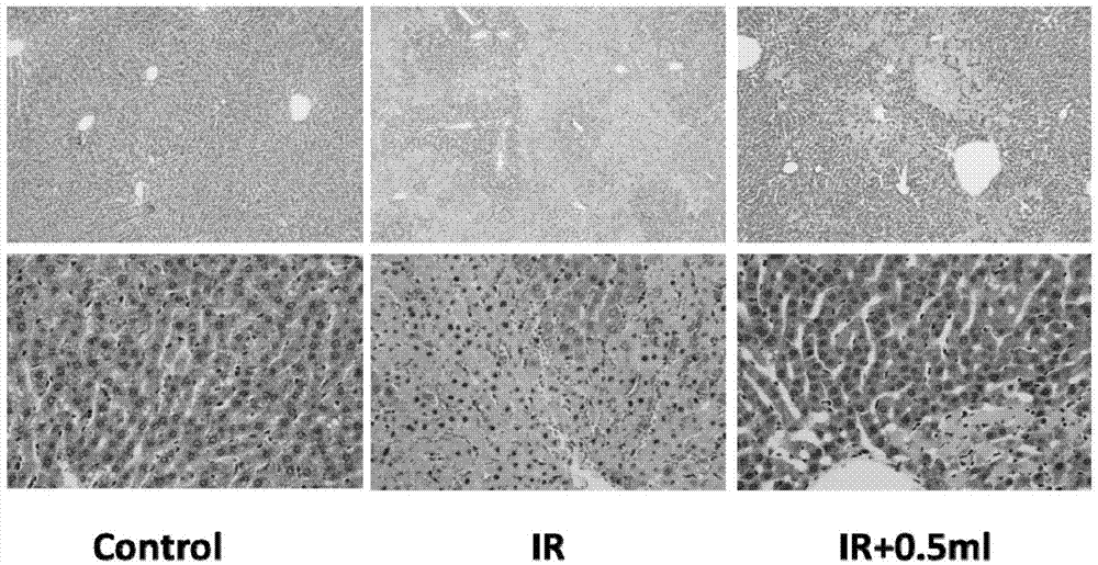 Application of methane injection in preparation of medicaments for treating ischemia-reperfusion injury