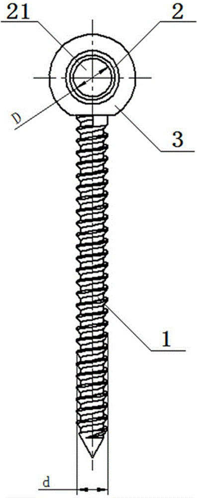 Self-adaptive pedicle screw