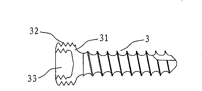 Minimally invasive dual-locking implantation system for cervical vertebra