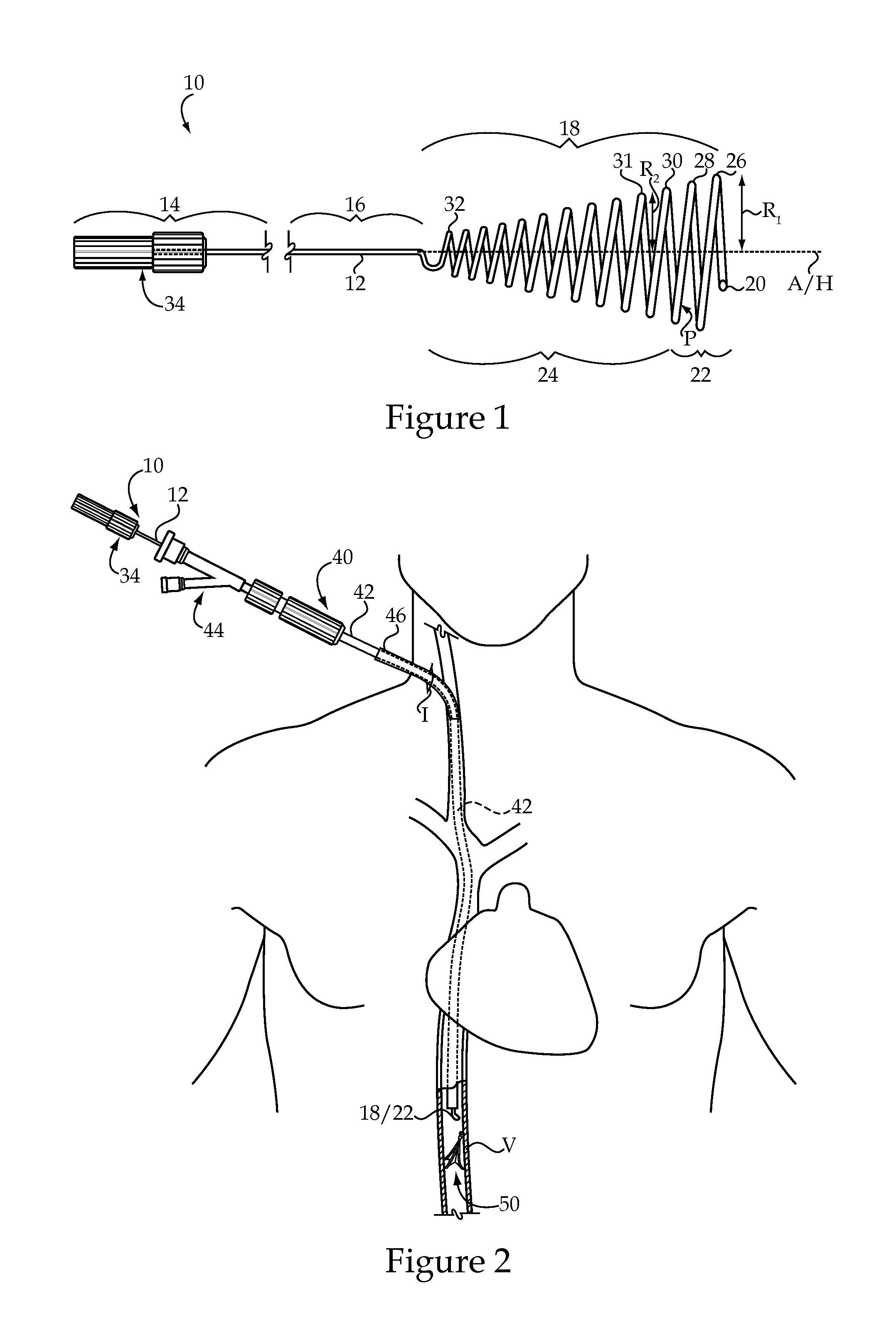 Vascular Implant Retrieval Method, Retrieval Assembly And Tool For Same