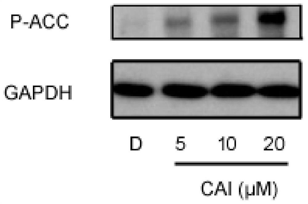 Use of carboxytriazole and glutamic acid uptake and metabolism inhibitors in antitumor