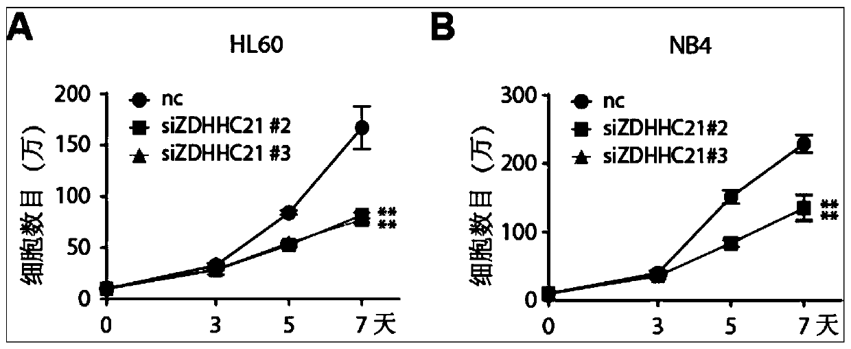 Application of ZDHHC21 genes in preparation of leukemia induced differentiation therapy drugs