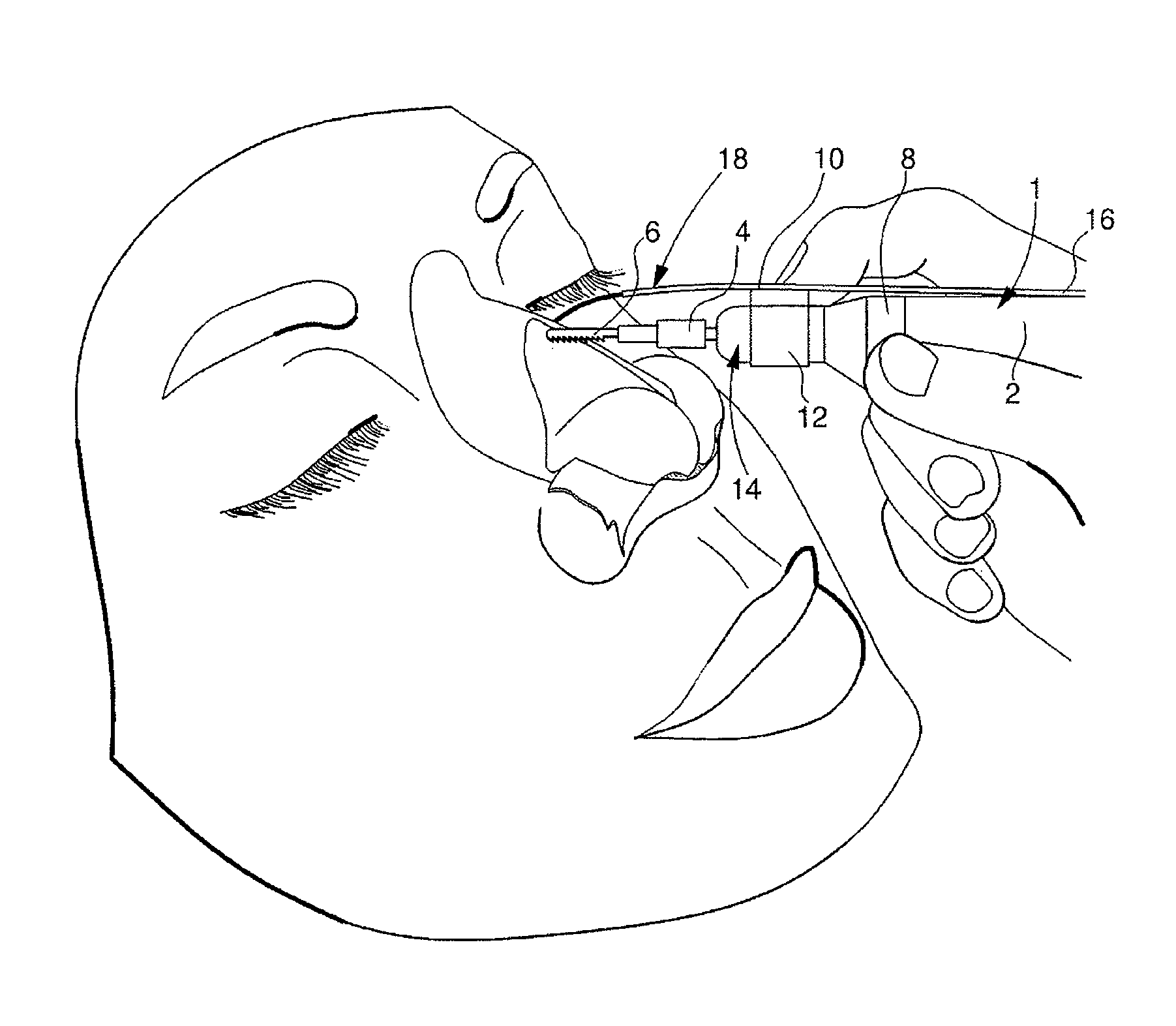 Coupling device between the drive shaft of a surgical instrument and a tool