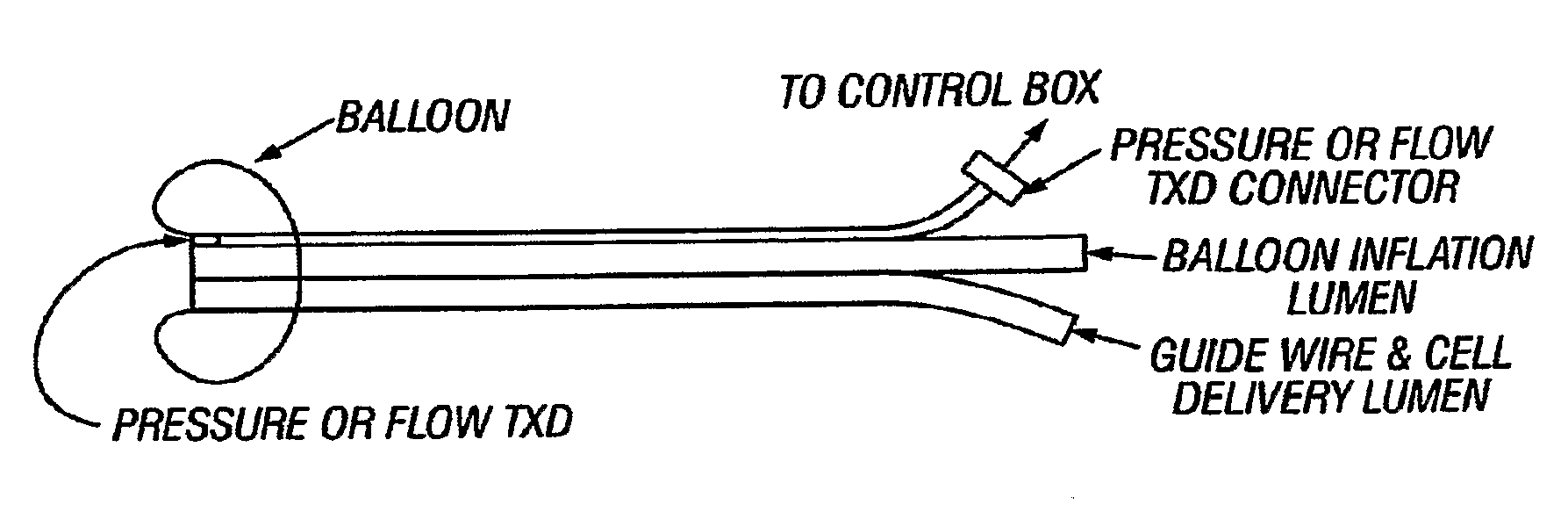 Cell delivery catheters with distal tip high fidelity sensors