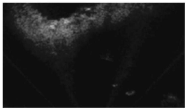 A method for underwater forward-looking sonar image segmentation based on modal mrf random field