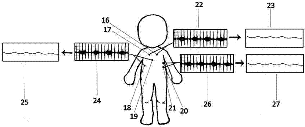 Device for detecting reversibility of airway