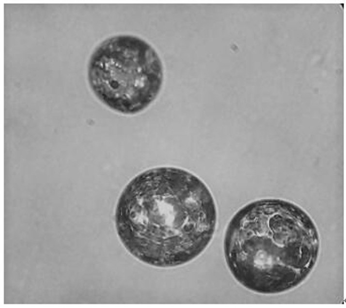 Microalgal oil microcapsule and preparation method thereof