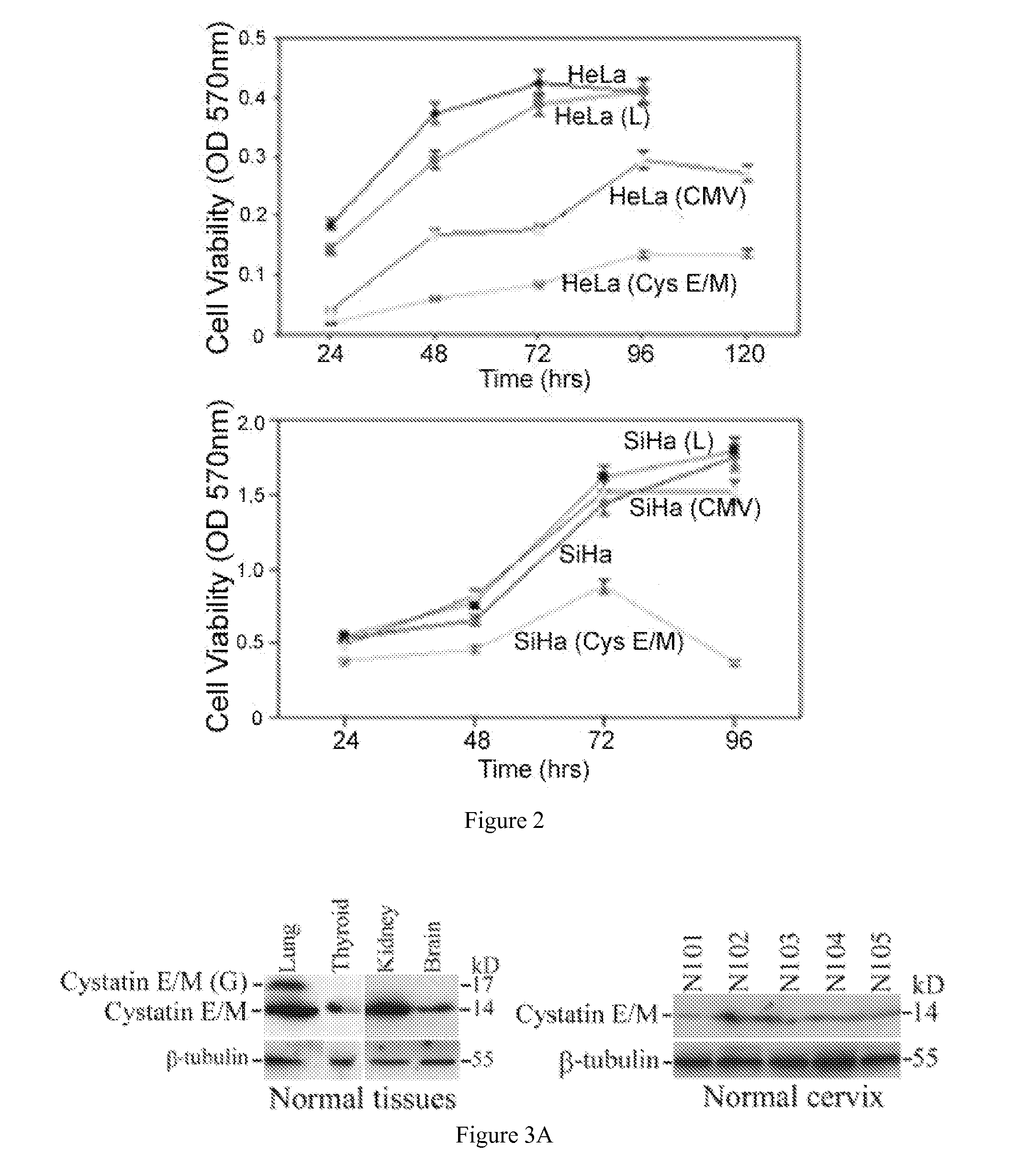 Methods and Compositions for Diagnosing and Treating Cervical Intraepithelial Neoplasia and Cervical Cancer