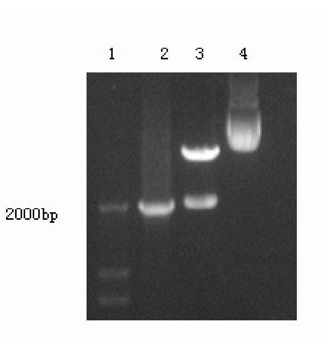 Fusion protein and encoding gene thereof as well as application of fusion protein