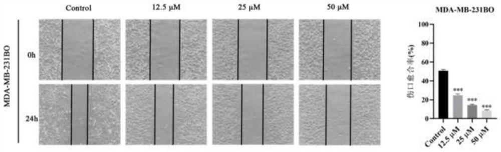 Application of curcuma zedoary extract in preparation of medicine for treating breast cancer bone metastasis