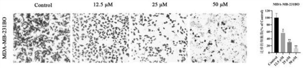 Application of curcuma zedoary extract in preparation of medicine for treating breast cancer bone metastasis