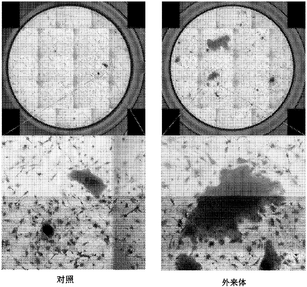 Mesenchymal stem cell-derived exosome