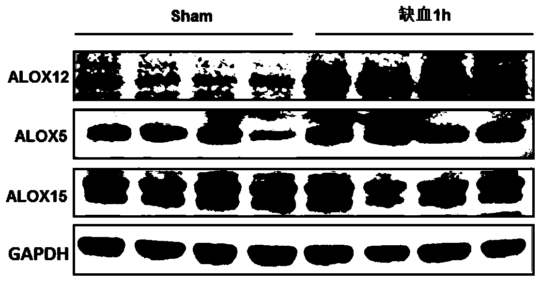 Application of alox12 inhibitor in the preparation of ischemia-reperfusion injury medicine