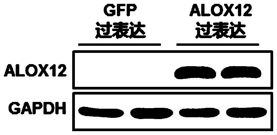 Application of alox12 inhibitor in the preparation of ischemia-reperfusion injury medicine