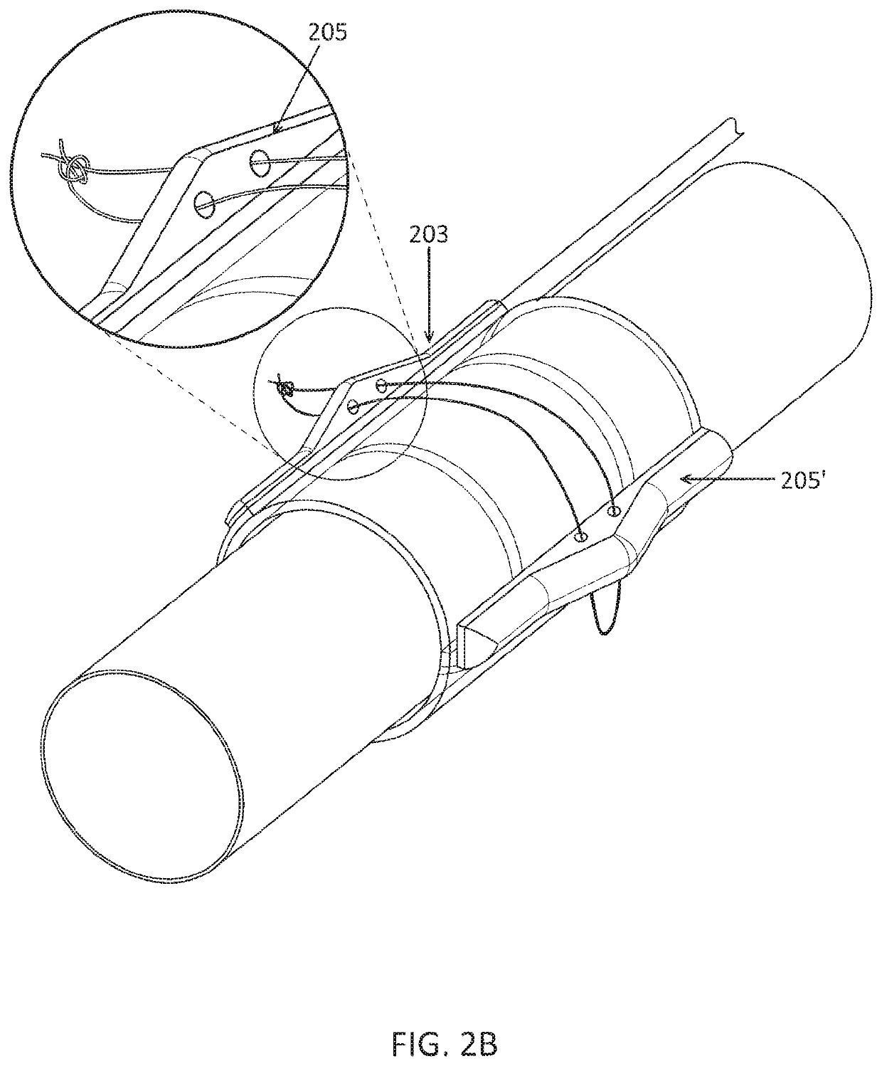 Nerve cuff deployment devices