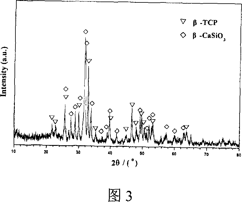 Method for preparing calcium silicate/beta- tricalcium phosphate composite powder by in situ chemical precipitation method