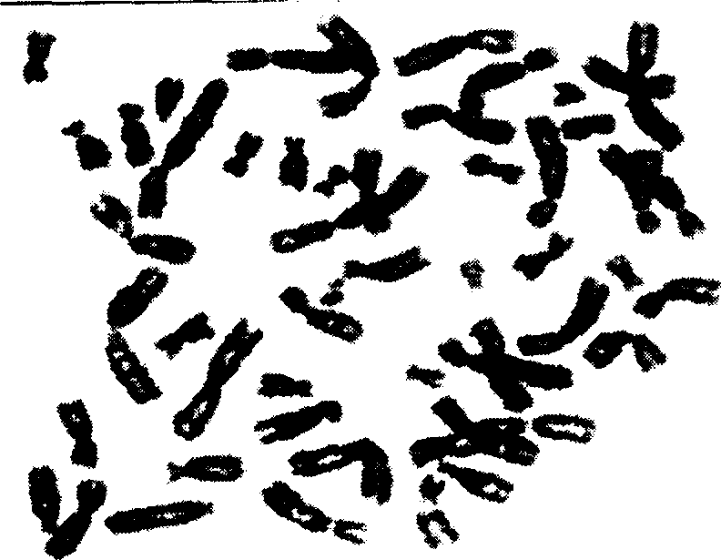 Human high metas tasis breast cancer cell line and setting method thereof