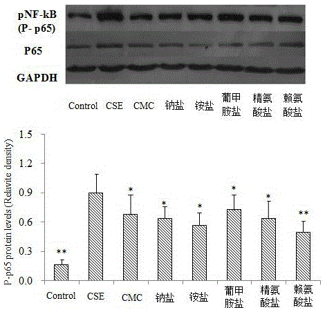 Application of S-(carboxymethyl)-L-cysteine to preparation of medicines for preventing and treating respiratory system diseases