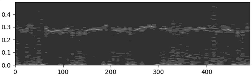 Cardiopulmonary coupling analysis method based on single-channel ECG signal