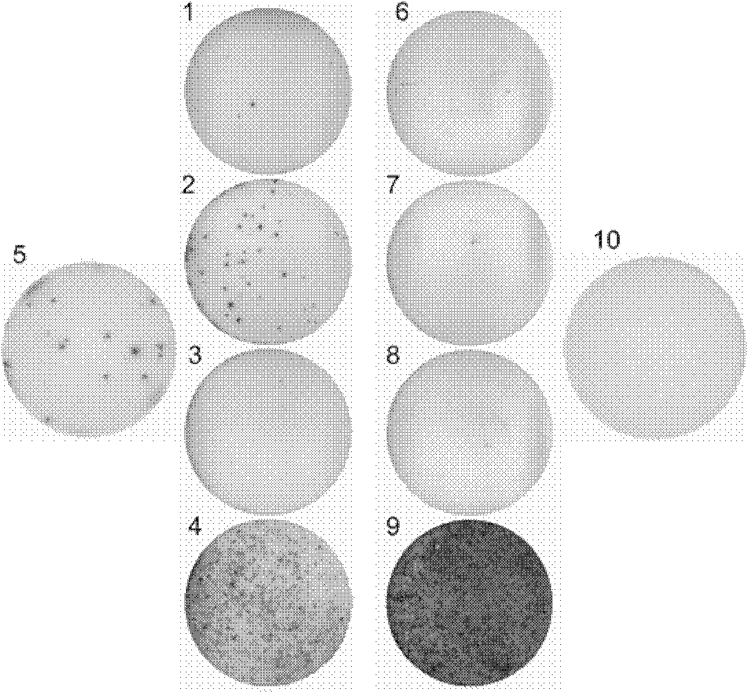 Epitope polypeptide applicable to mycobacterium tuberculosis infection detection and application thereof