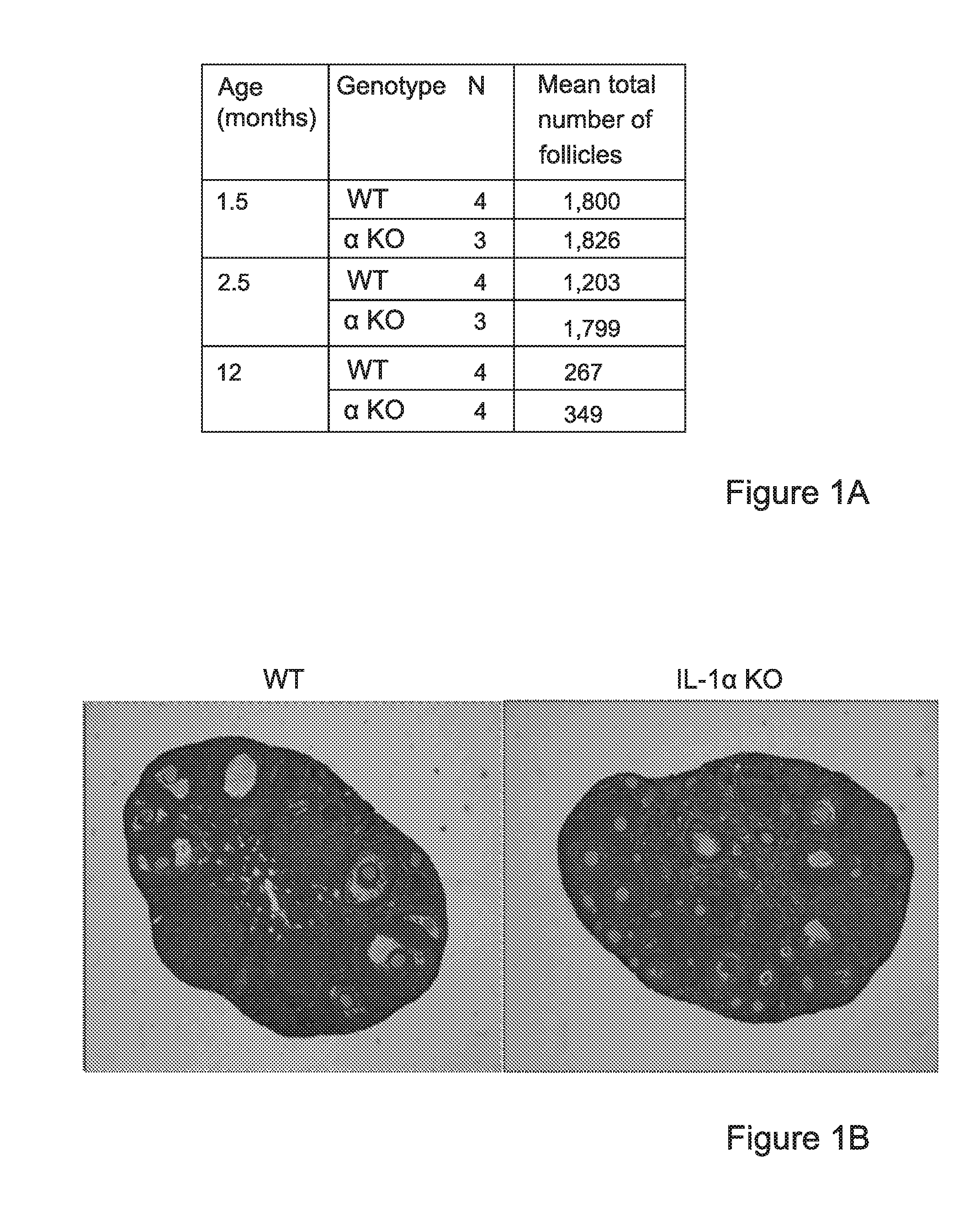 Interleukin-1 (il-1) inhibitors for treating fertility disorders