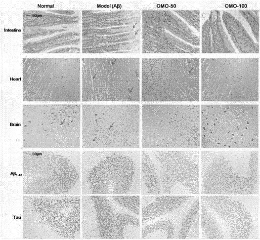 Applications of morinda officinalis how fructo oligosaccharide extract in preparation of drugs, health products or food for prevention and treatment of Alzheimer's disease