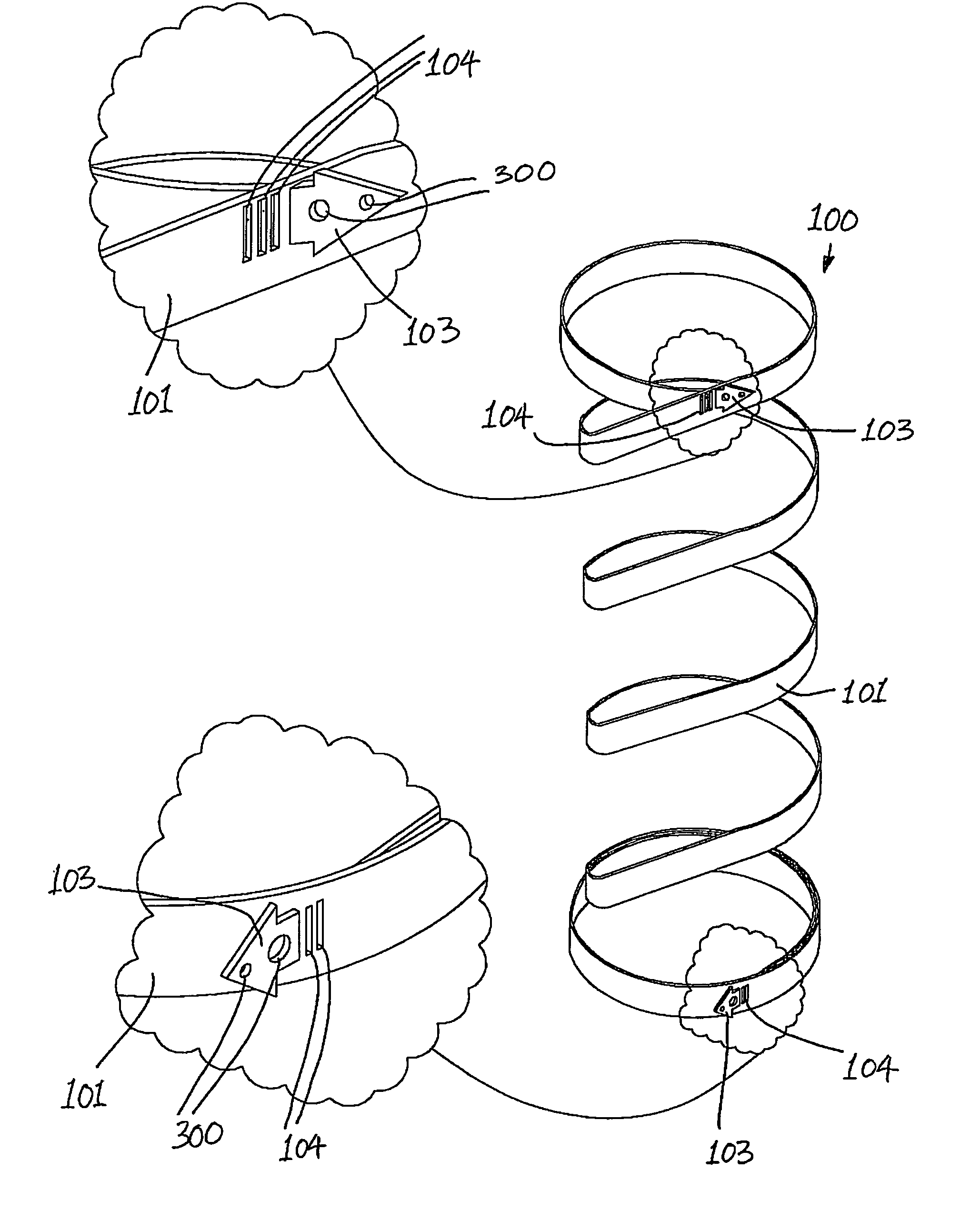 Gastric constriction device