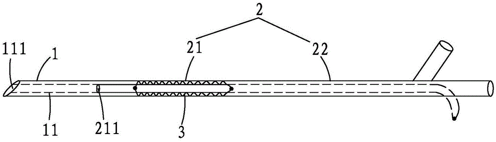 Reversible laser balloon catheter and method for applying same