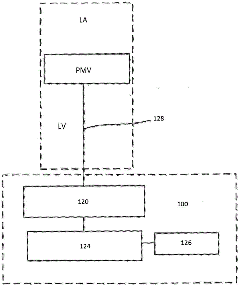 Epicardial anchor devices and methods