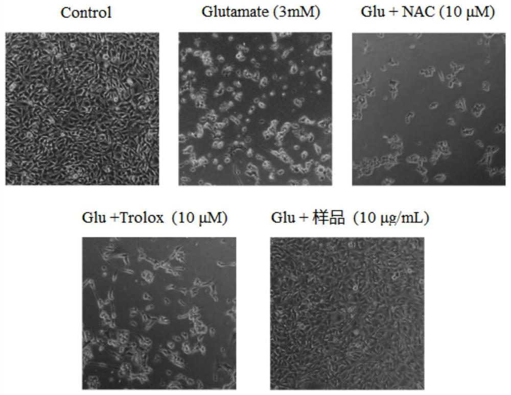 Application and medicine of Xiaohua Shiwancuo in the preparation of medicines for preventing and/or treating neurodegenerative diseases