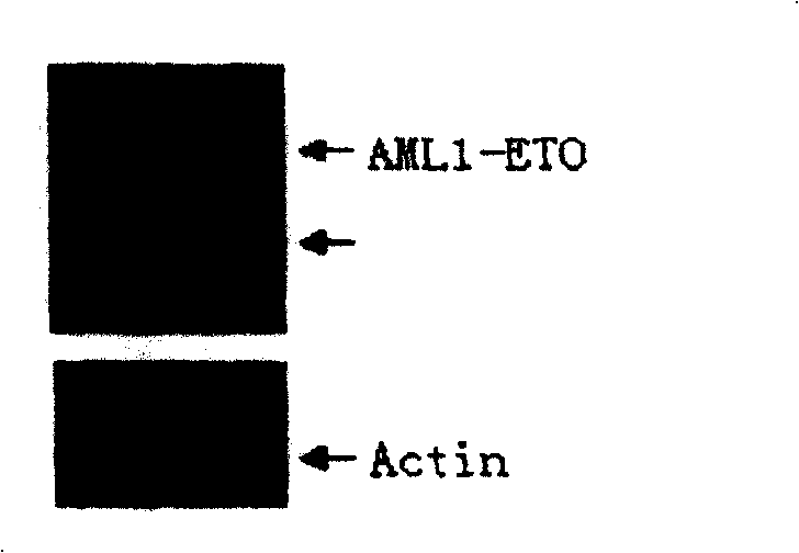 Application of compound PS-341 in preparation of medicine for treating acute pulp leucocythemia