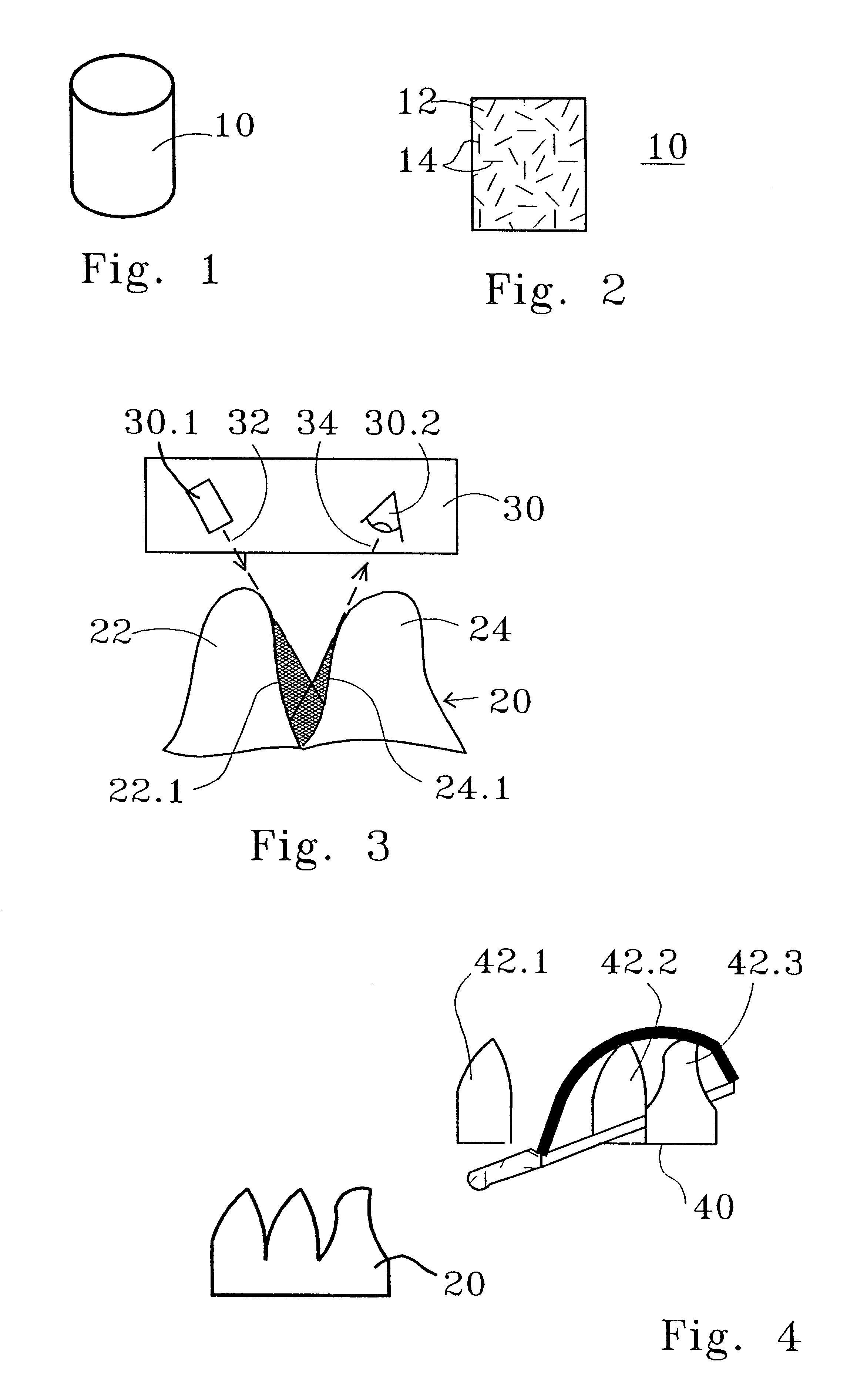 Material for a dental prosthesis, method and device for determining the shape of a remaining tooth area to be provided with a dental prosthesis, method and arrangement for producing a dental prosthesis and use of the arrangement