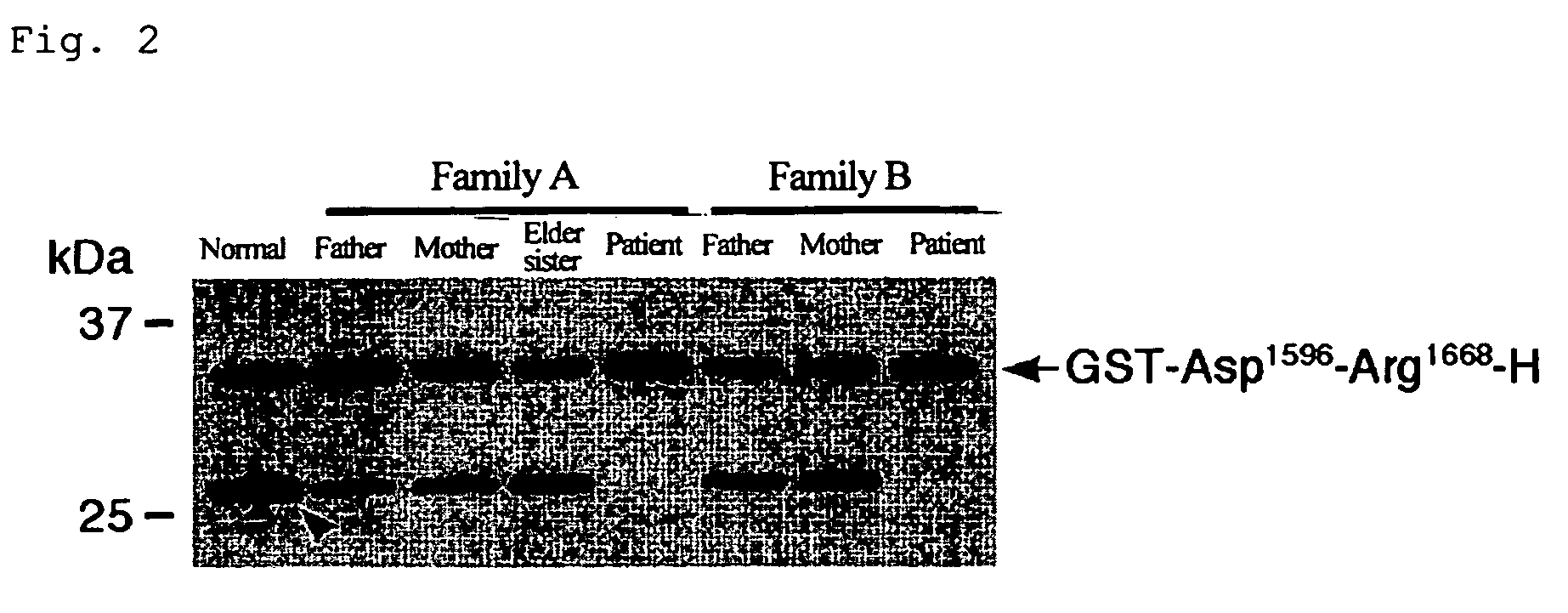 Substrate polyeptides for von Willebrand factor cleaving protease ADAMTS-13