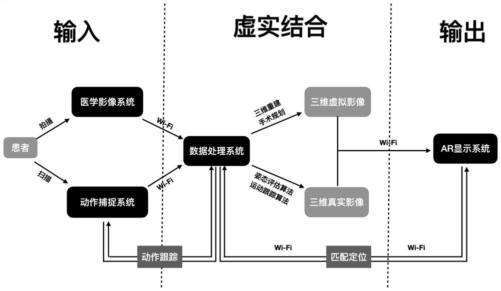 Dental operation real-time auxiliary system based on augmented reality three-dimensional imaging