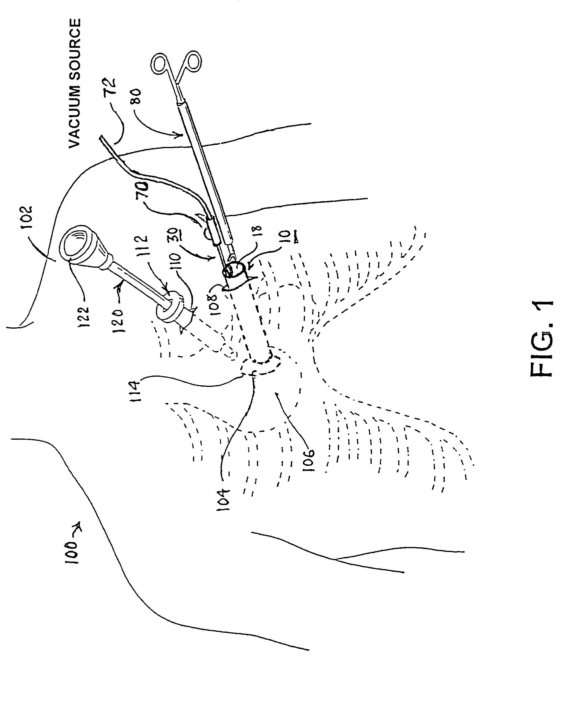 Methods and tools for accessing an anatomic space