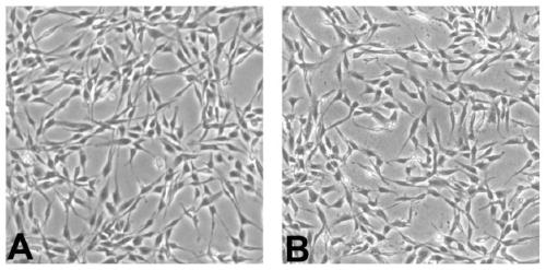 Recombinant adipose-derived stem cell for overexpression of Hpgds and preparation method and application thereof