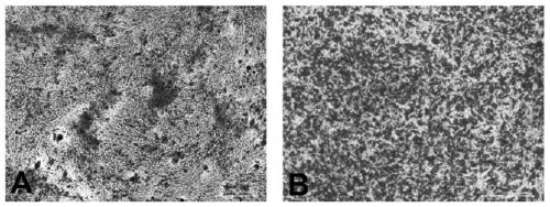 Recombinant adipose-derived stem cell for overexpression of Hpgds and preparation method and application thereof