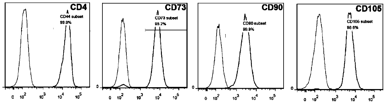 Recombinant adipose-derived stem cell for overexpression of Hpgds and preparation method and application thereof