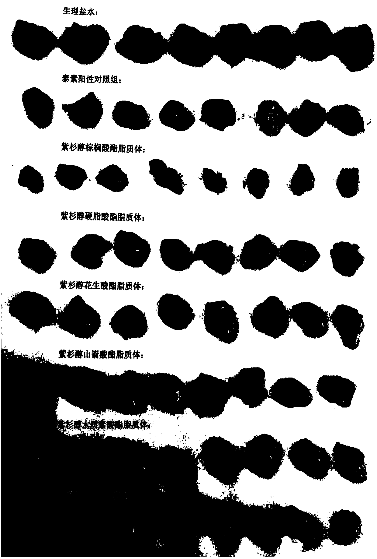 A kind of paclitaxel palmitate liposome and preparation method thereof