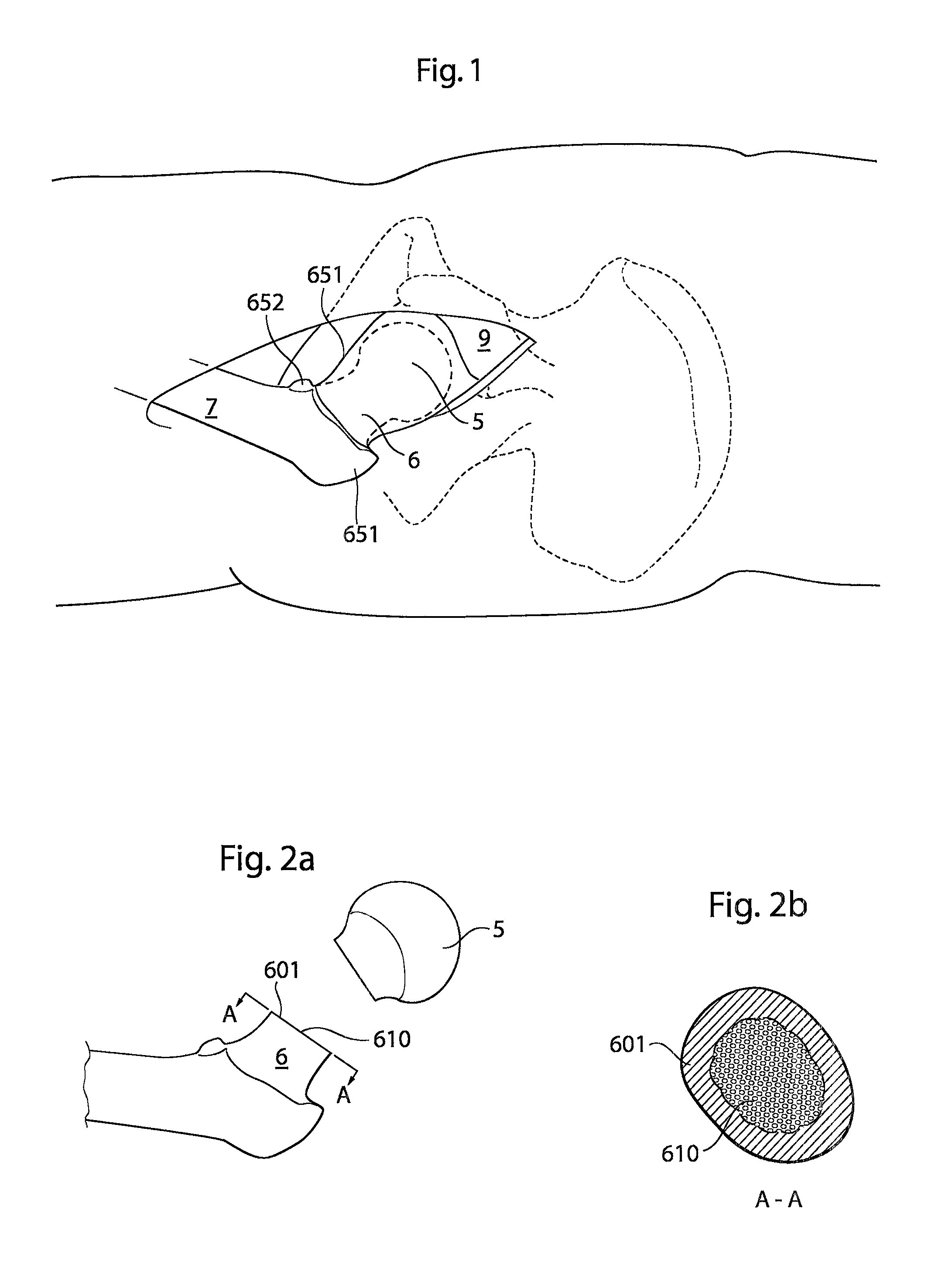 Hip joint device