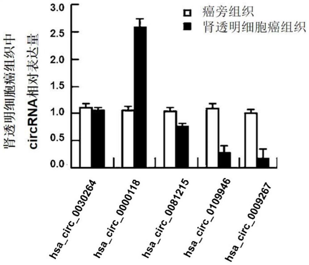 Renal clear cell carcinoma circRNA biomarker, screening method and diagnostic kit