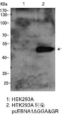 A kind of synthetic ebv consensus sequence molecular dna vaccine and its application