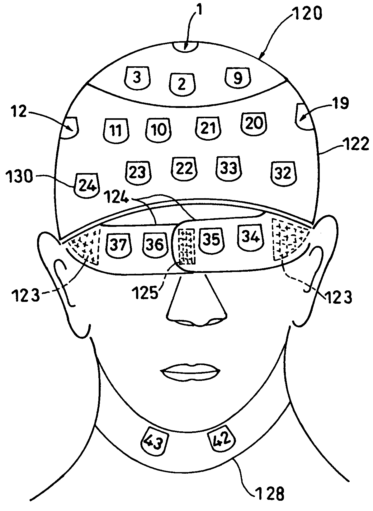 Dosimeter fitting wear and body surface exposure dose distribution measuring method and apparatus using the same