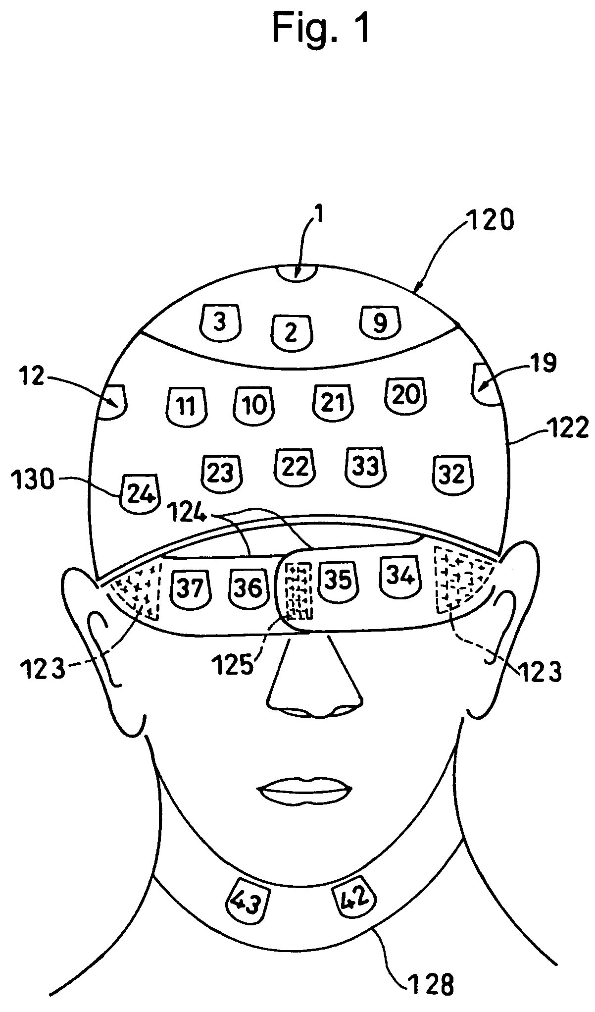 Dosimeter fitting wear and body surface exposure dose distribution measuring method and apparatus using the same