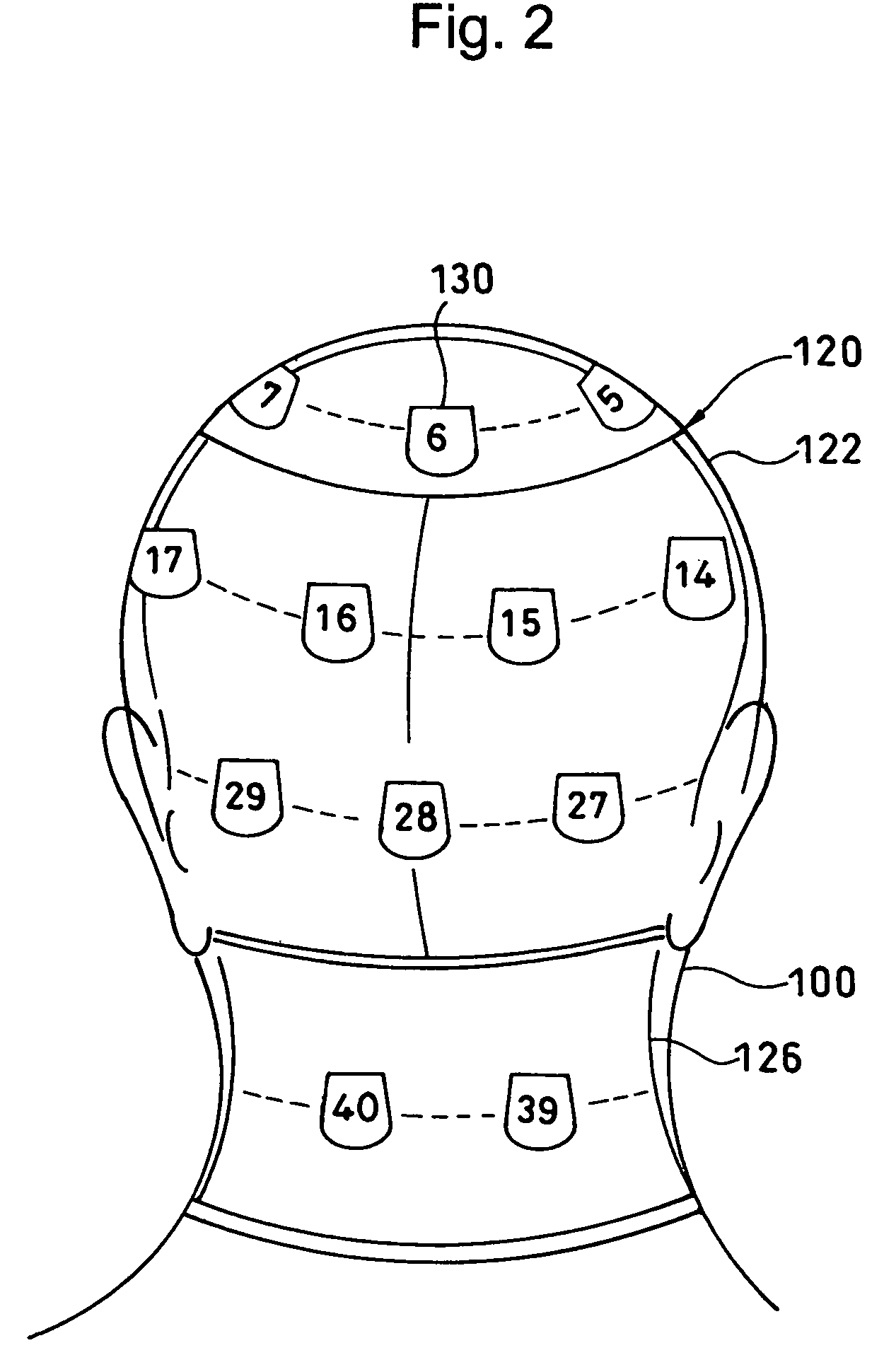 Dosimeter fitting wear and body surface exposure dose distribution measuring method and apparatus using the same