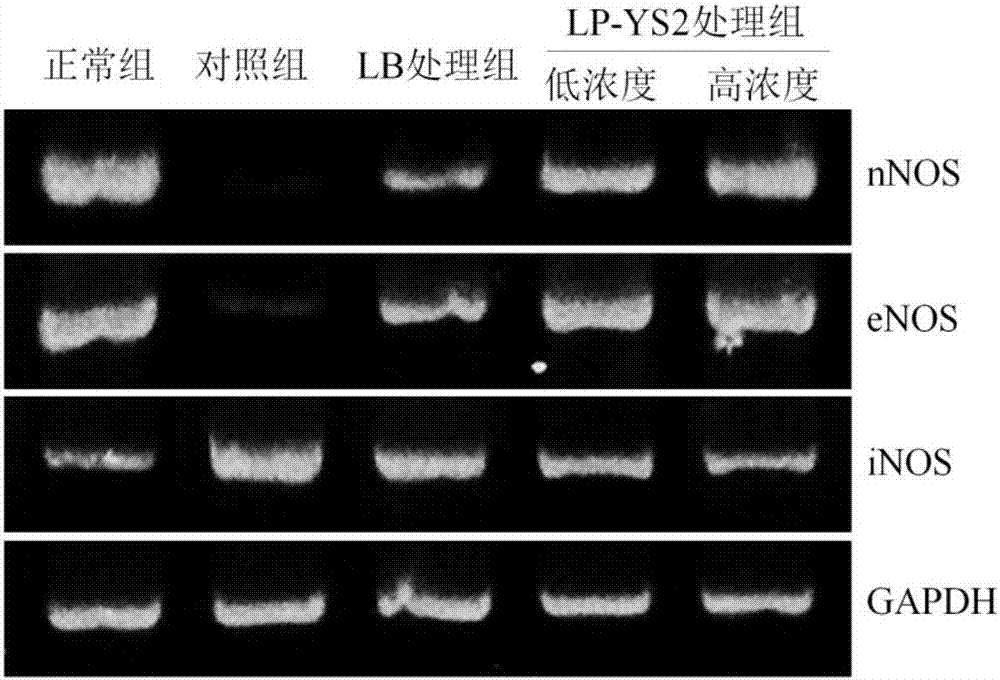 Application of lactobacillus plantarum YS2 in preparation of foods or medicines for preventing ulcerative colitis