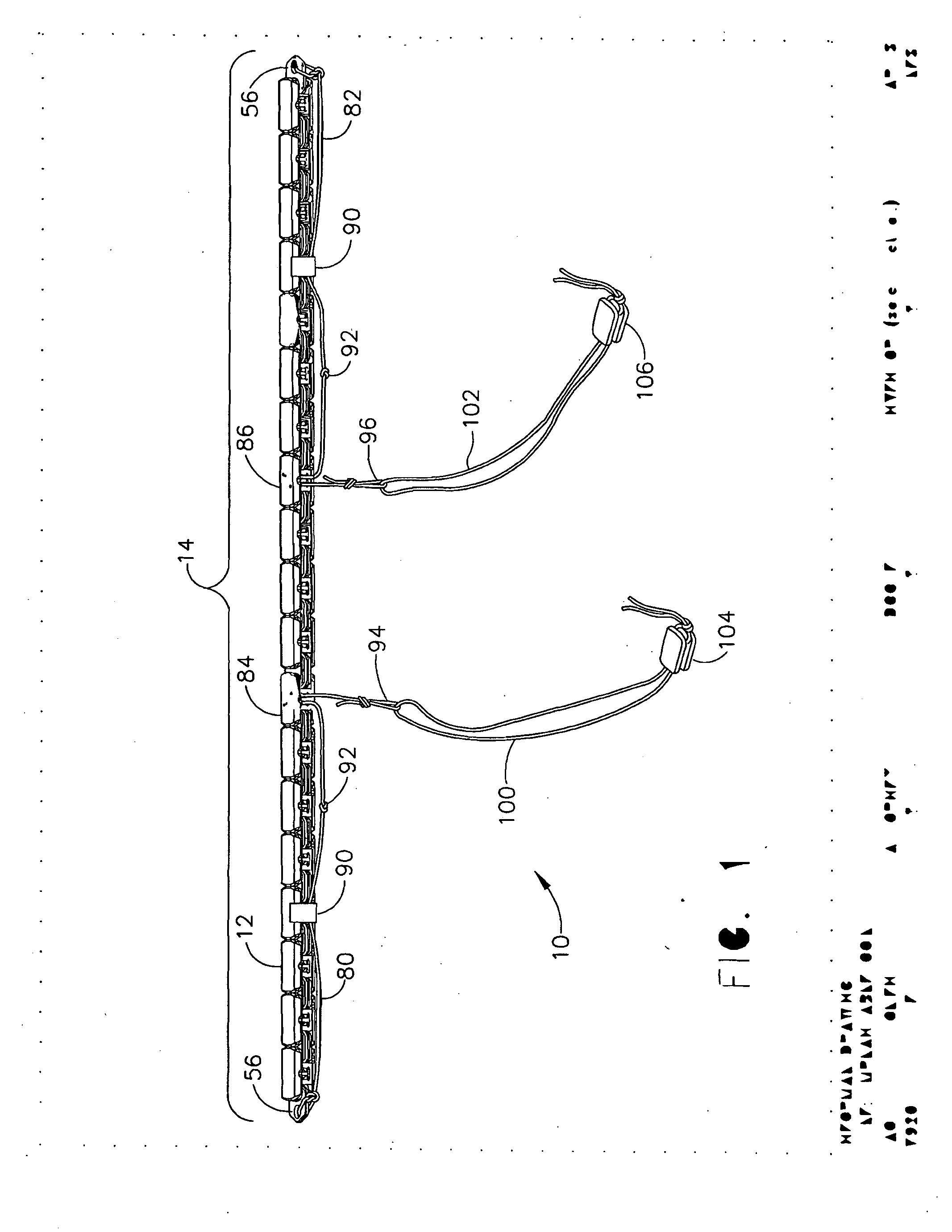 Implantable device for the treatment of obesity